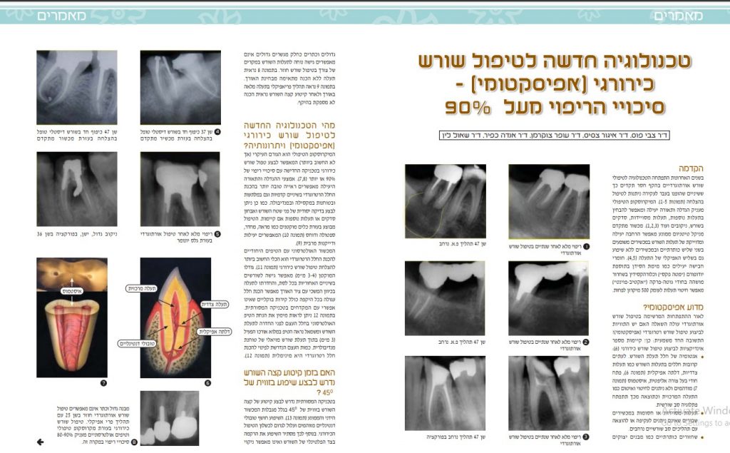 אפיקו